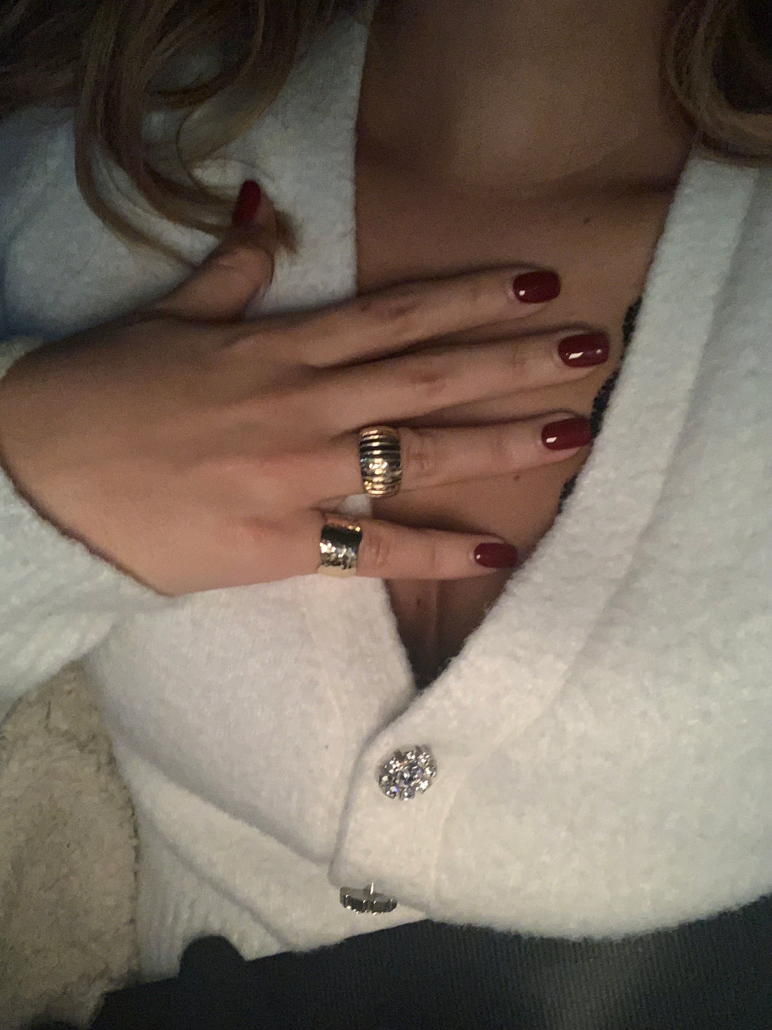 Anello veronese